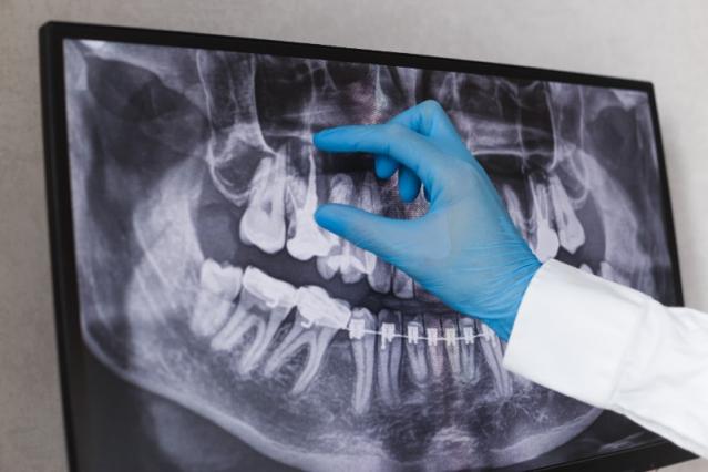 Contrôle et radiologie dentaire