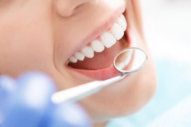 Pose d'implants dentaires
