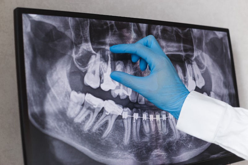 Contrôle et radiologie dentaire